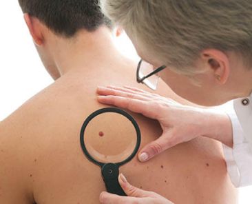 Tumori della pelle e prevenzione-480x360px